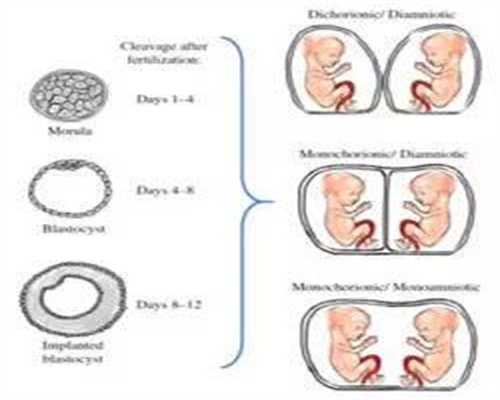正规的代怀孕机构 ：代孕早期用药或进行辐射性