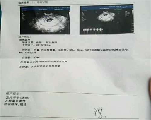 北京代孕可信吗：宫腔内人工授精手术前要准备