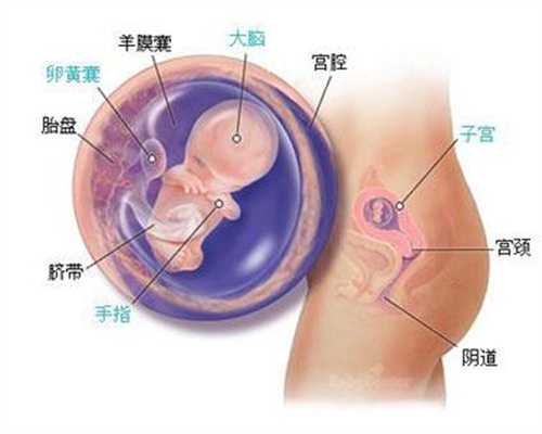 哪里可以合法代孕：精索静脉曲张怎么检查