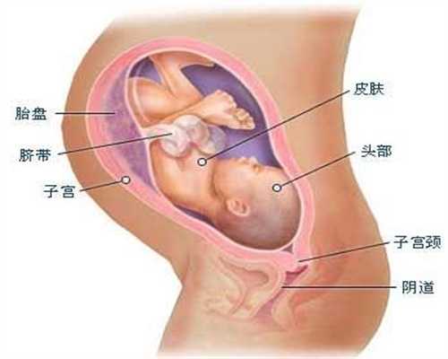 北京长江代孕：输卵管粘连较常见原因有哪些