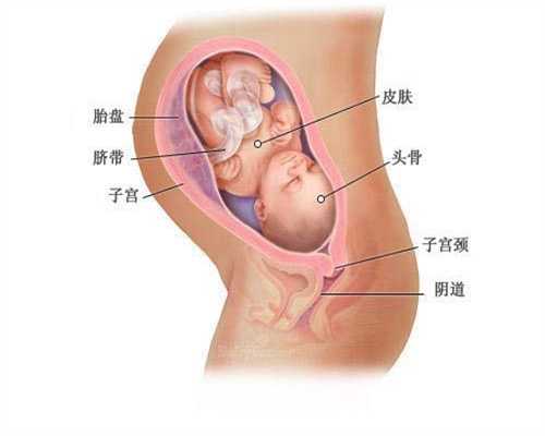 北京长江代孕：输卵管粘连较常见原因有哪些
