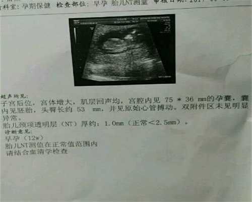 北京高鹰代孕：卵巢早衰有哪些常见的症状呢