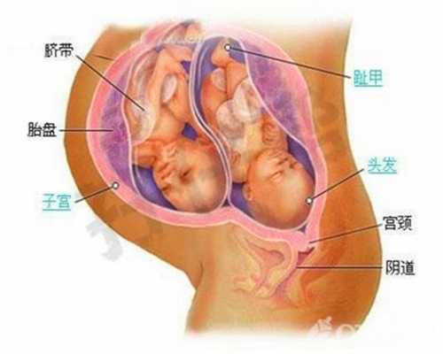北京陈艳代孕：引起宫颈性不孕的原因是什么