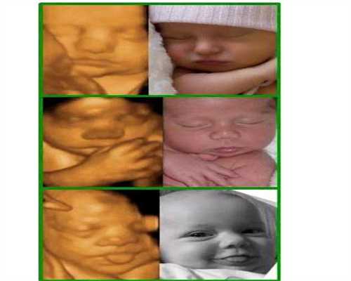 本溪供卵代孕,试管婴儿“养囊”的五大优点提高