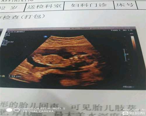 北京代怀孕哪家好_最便宜北京代怀孕价格_【健康科普】女性宫颈囊肿需要手术吗？
