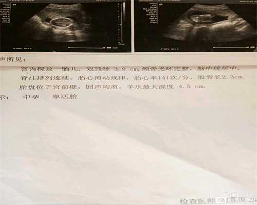 北京非孕价格-北京允许代孕吗