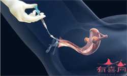 正规杭州代孕中心查询,北京的代孕机构排名怎么样？附试管代孕？